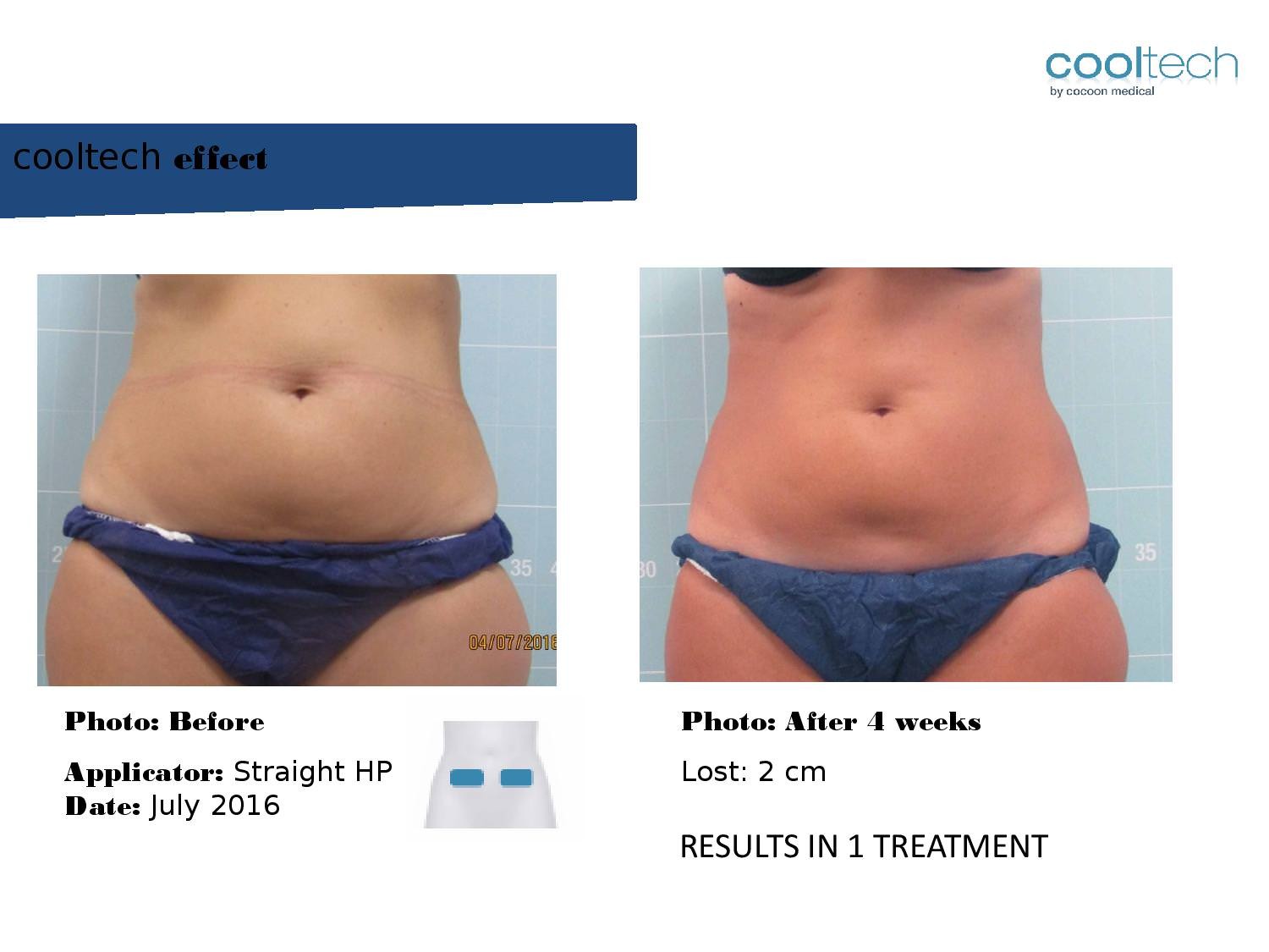 Presentation Cooltech ENG Wigmore Days Novaaaa1-page-005